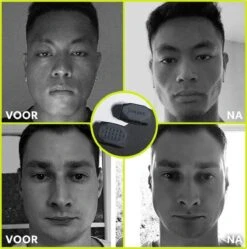 Kaaklijn Jawline Trainer Sport Fitness Kaak Trainer Gym Jawliner - Variant Advanced - Kaaklijn Onderkin Gezichtstrainer - Jawliner® -Fit Verkoop 1191x1200 4