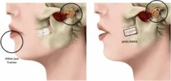 Kaaklijn Jawline Trainer Sport Fitness Kaak Trainer Gym Jawliner - Variant Advanced - Kaaklijn Onderkin Gezichtstrainer - Jawliner® -Fit Verkoop 1200x572